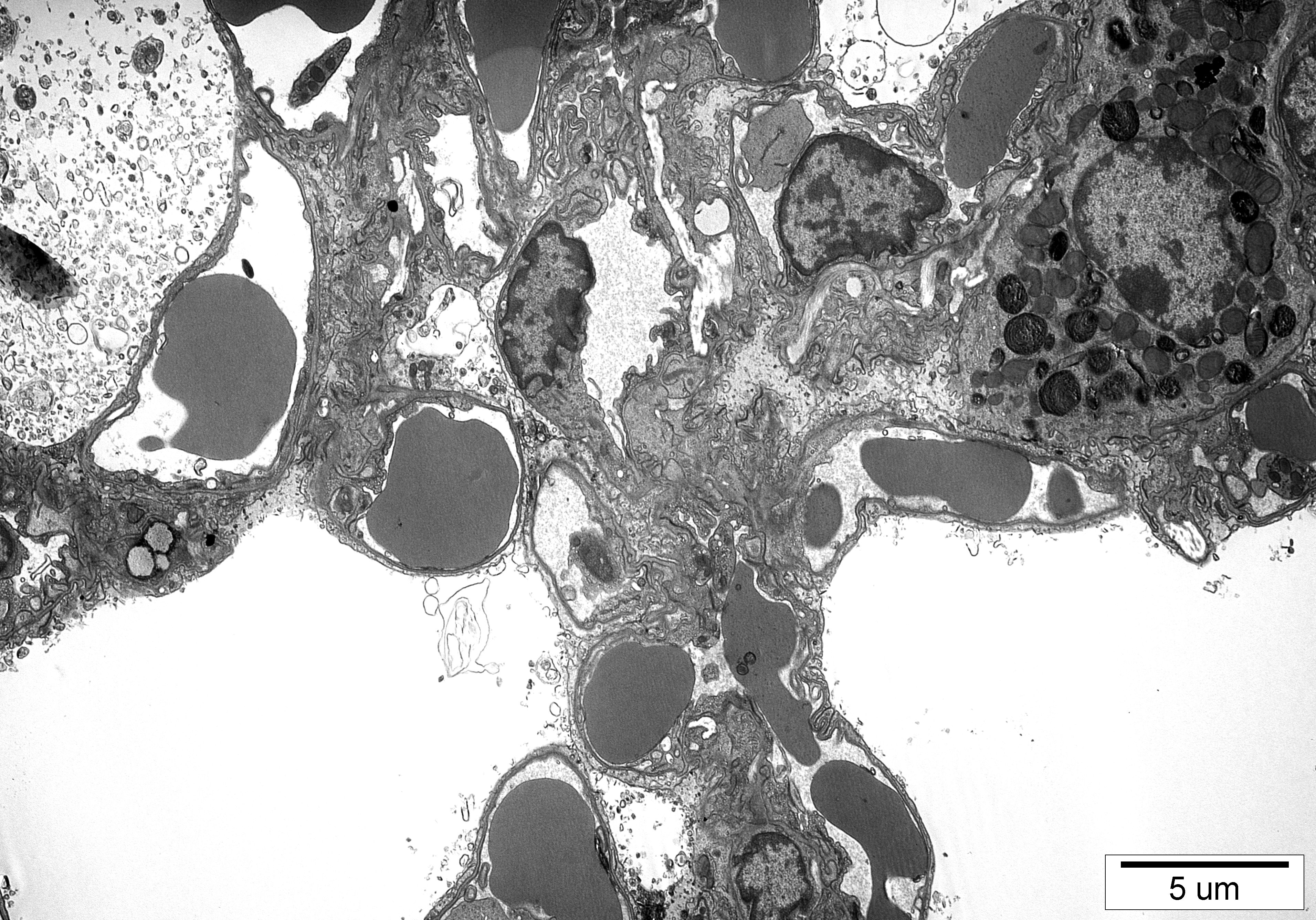 7. Płuco T. Skirecki CMKP zdj. M.Gewartowska